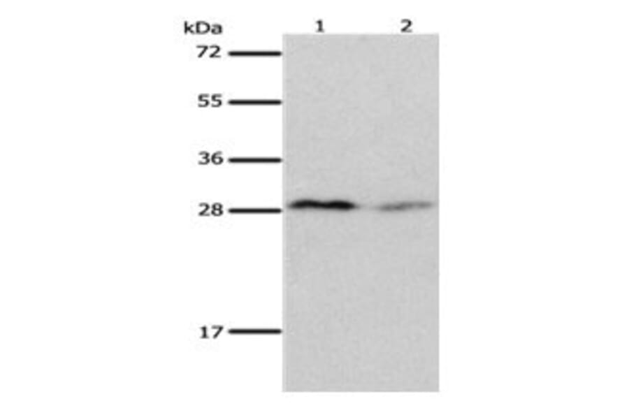 KLK7 Antibody from Signalway Antibody (31093) - Antibodies.com
