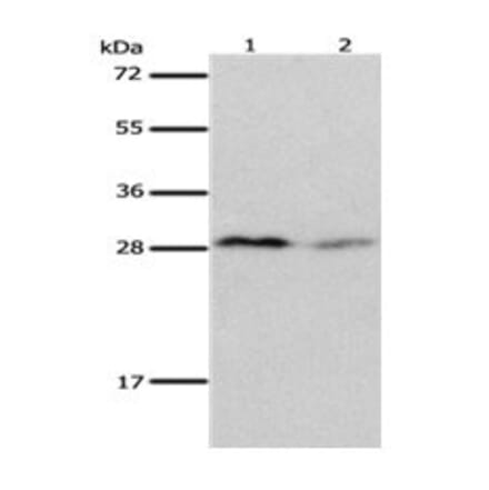 KLK7 Antibody from Signalway Antibody (31093) - Antibodies.com