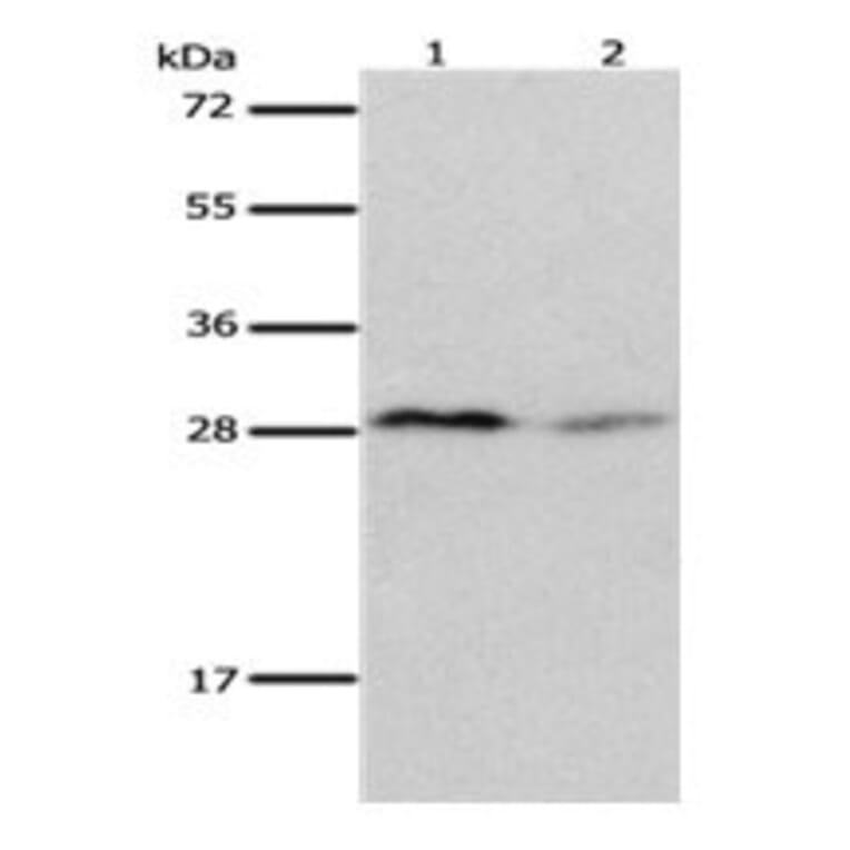 KLK7 Antibody from Signalway Antibody (31093) - Antibodies.com