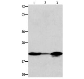 NME1 Antibody from Signalway Antibody (31103) - Antibodies.com