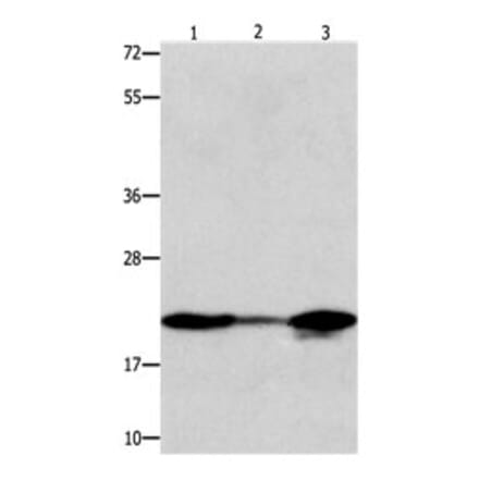 NME1 Antibody from Signalway Antibody (31103) - Antibodies.com