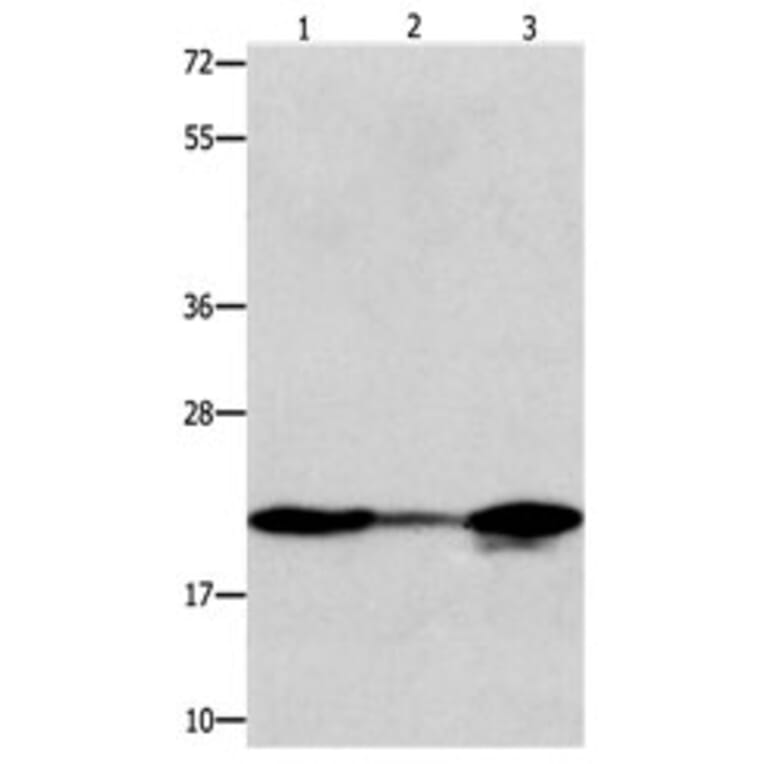 NME1 Antibody from Signalway Antibody (31103) - Antibodies.com