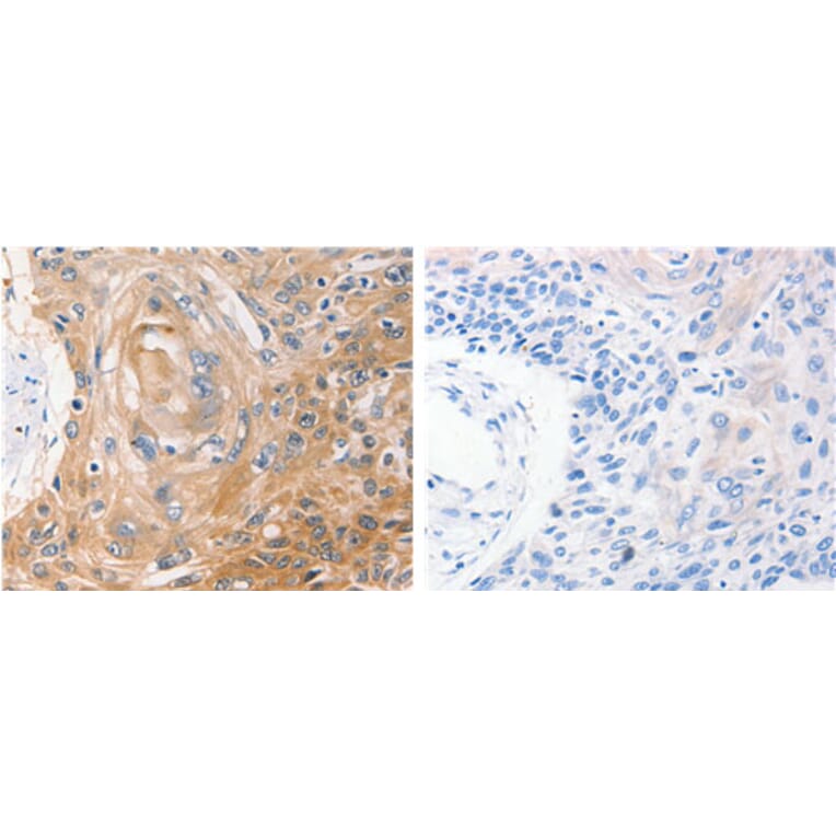 NME1 Antibody from Signalway Antibody (31103) - Antibodies.com