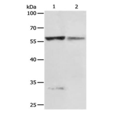 PRCP Antibody from Signalway Antibody (31116) - Antibodies.com