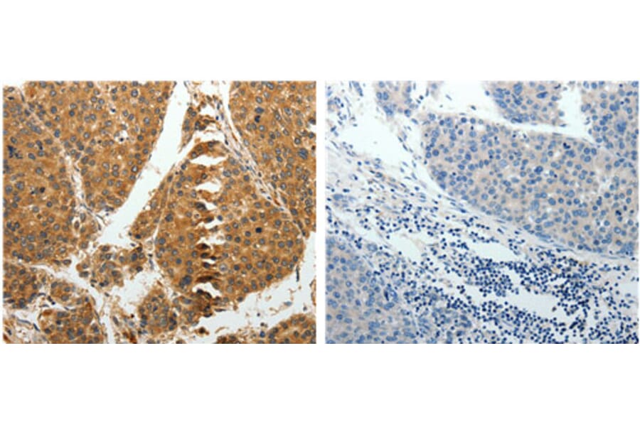 RRM1 Antibody from Signalway Antibody (31118) - Antibodies.com