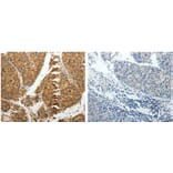 RRM1 Antibody from Signalway Antibody (31118) - Antibodies.com