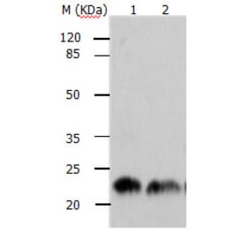 ARF1 Antibody from Signalway Antibody (31145) - Antibodies.com