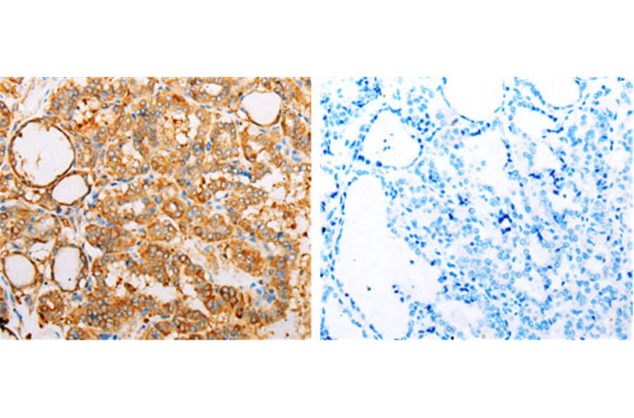 ARF1 Antibody from Signalway Antibody (31145) - Antibodies.com