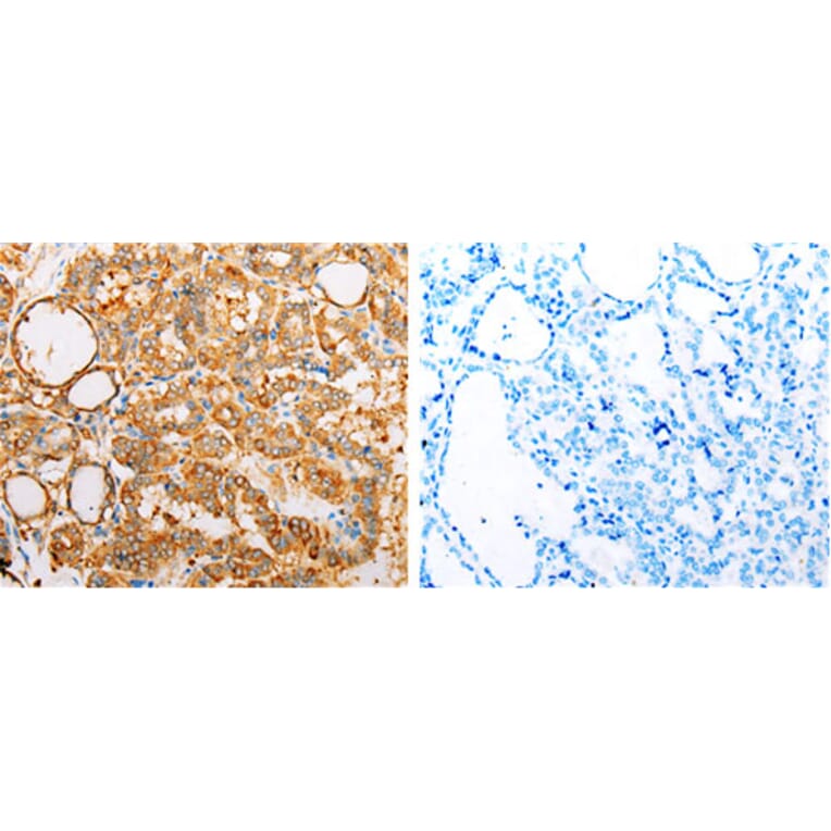 ARF1 Antibody from Signalway Antibody (31145) - Antibodies.com