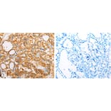 ARF1 Antibody from Signalway Antibody (31145) - Antibodies.com