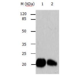 ARF6 Antibody from Signalway Antibody (31146) - Antibodies.com