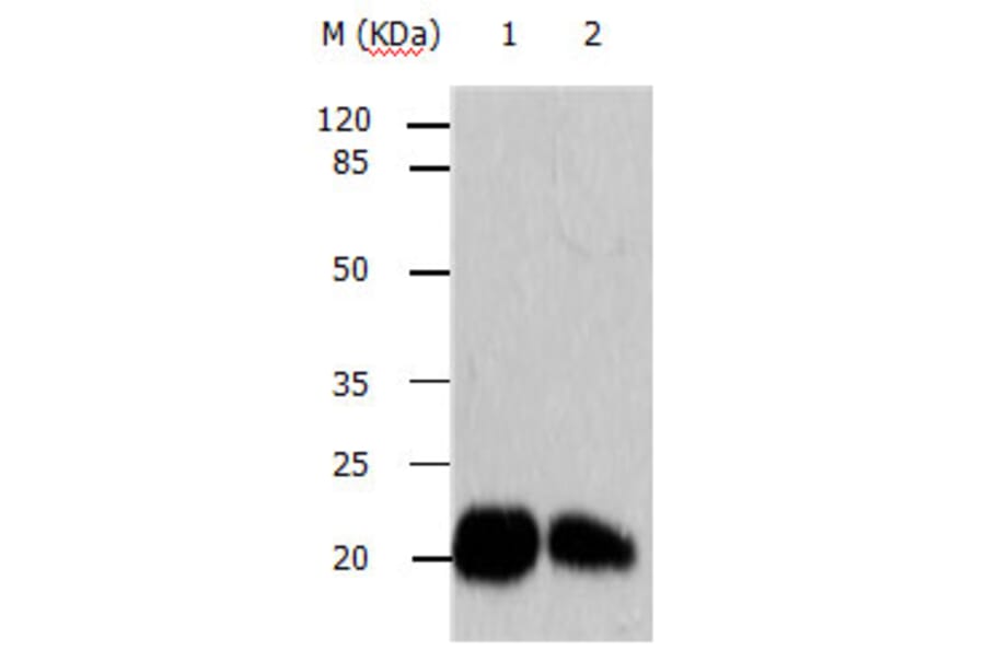 ARF6 Antibody from Signalway Antibody (31146) - Antibodies.com