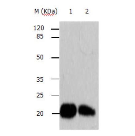 ARF6 Antibody from Signalway Antibody (31146) - Antibodies.com
