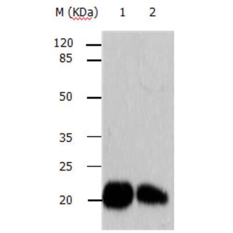 ARF6 Antibody from Signalway Antibody (31146) - Antibodies.com