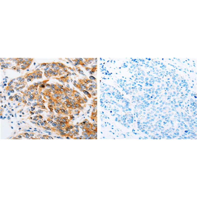 ARF6 Antibody from Signalway Antibody (31146) - Antibodies.com