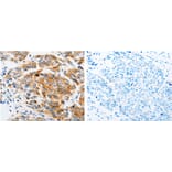 ARF6 Antibody from Signalway Antibody (31146) - Antibodies.com