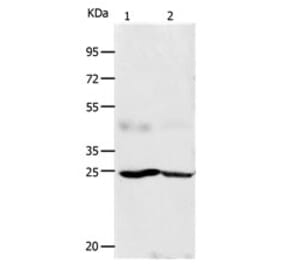 FGF7 Antibody from Signalway Antibody (31162) - Antibodies.com