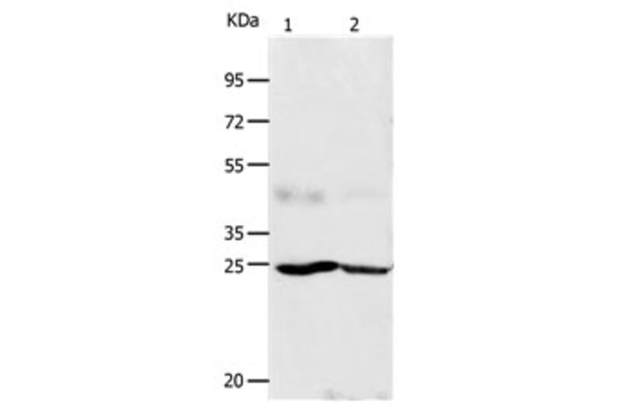 FGF7 Antibody from Signalway Antibody (31162) - Antibodies.com