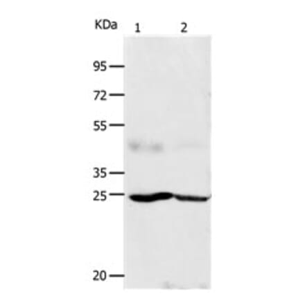 FGF7 Antibody from Signalway Antibody (31162) - Antibodies.com