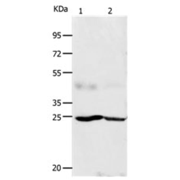 FGF7 Antibody from Signalway Antibody (31162) - Antibodies.com