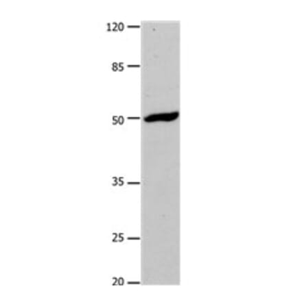 DRD1 Antibody from Signalway Antibody (31180) - Antibodies.com