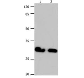 GJB6 Antibody from Signalway Antibody (31190) - Antibodies.com