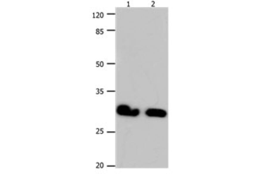 GJB6 Antibody from Signalway Antibody (31190) - Antibodies.com