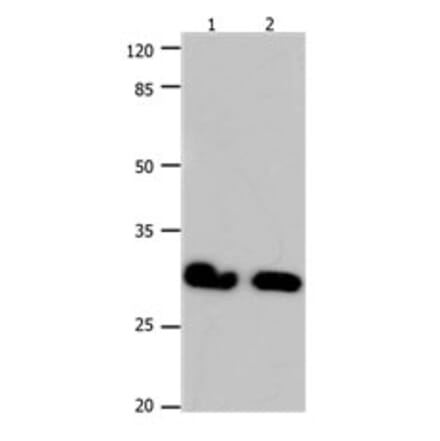 GJB6 Antibody from Signalway Antibody (31190) - Antibodies.com