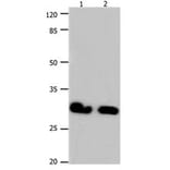 GJB6 Antibody from Signalway Antibody (31190) - Antibodies.com