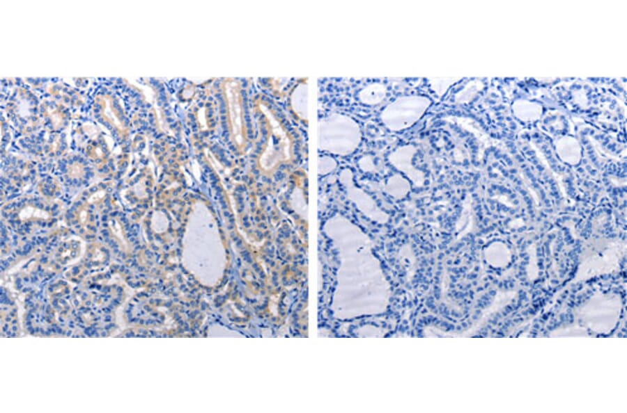 GJB6 Antibody from Signalway Antibody (31190) - Antibodies.com