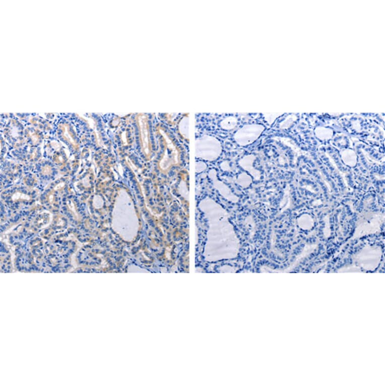 GJB6 Antibody from Signalway Antibody (31190) - Antibodies.com