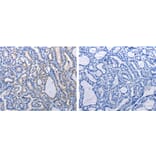 GJB6 Antibody from Signalway Antibody (31190) - Antibodies.com