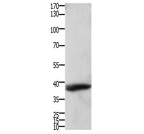 TPM2 Antibody from Signalway Antibody (31199) - Antibodies.com