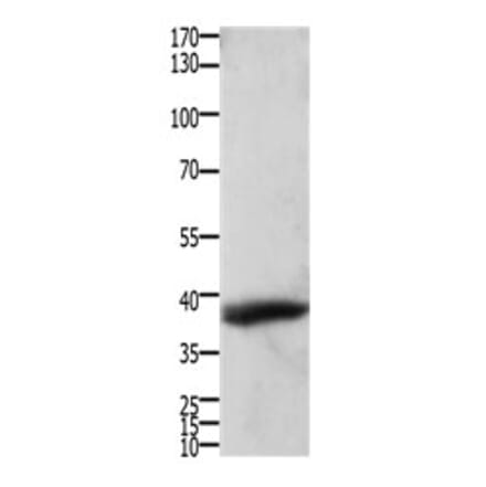 TPM2 Antibody from Signalway Antibody (31199) - Antibodies.com