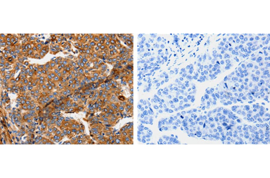 TPM2 Antibody from Signalway Antibody (31199) - Antibodies.com