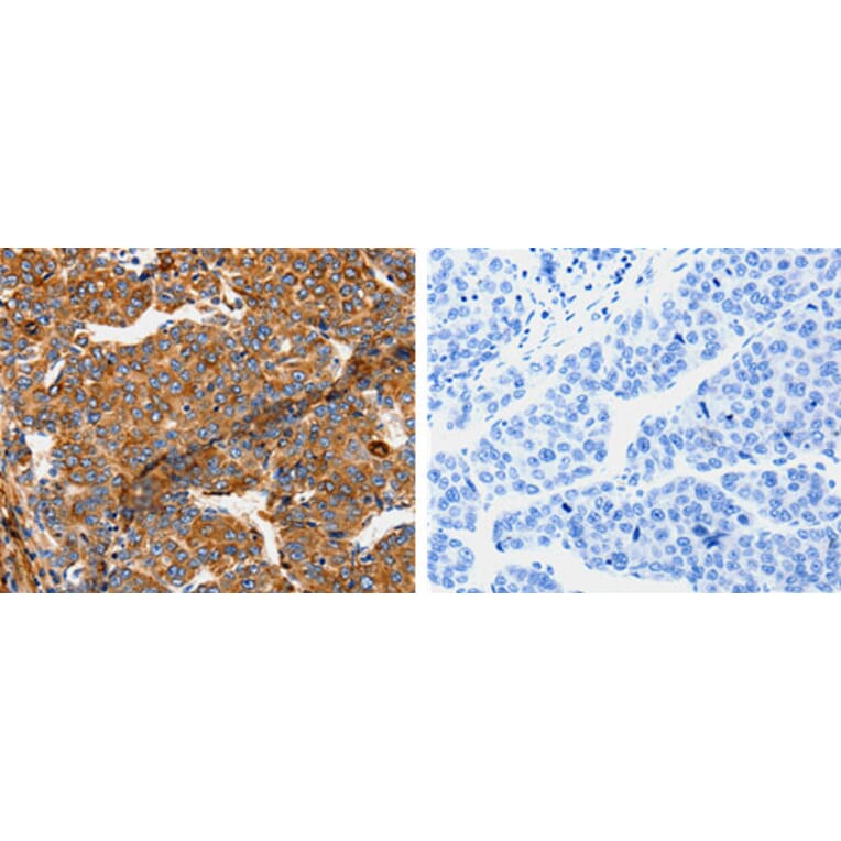 TPM2 Antibody from Signalway Antibody (31199) - Antibodies.com