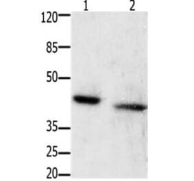 GRPR Antibody from Signalway Antibody (31200) - Antibodies.com