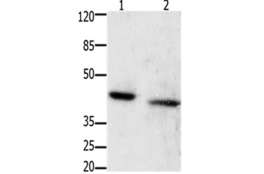 GRPR Antibody from Signalway Antibody (31200) - Antibodies.com
