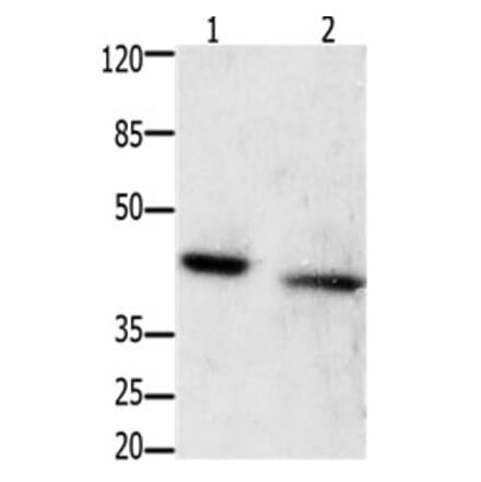 GRPR Antibody from Signalway Antibody (31200) - Antibodies.com