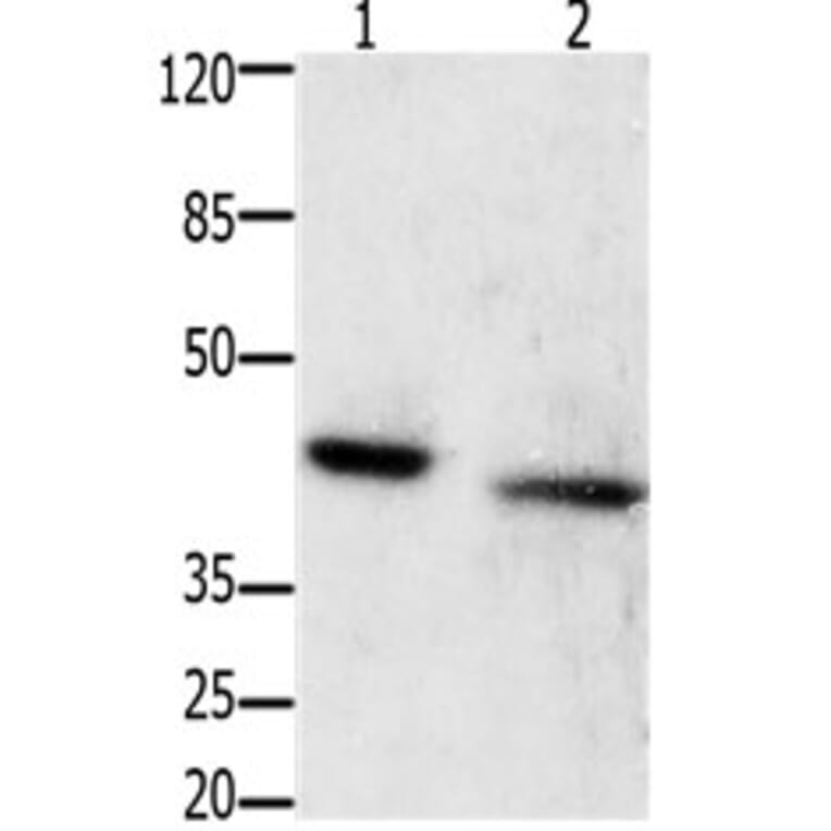 GRPR Antibody from Signalway Antibody (31200) - Antibodies.com