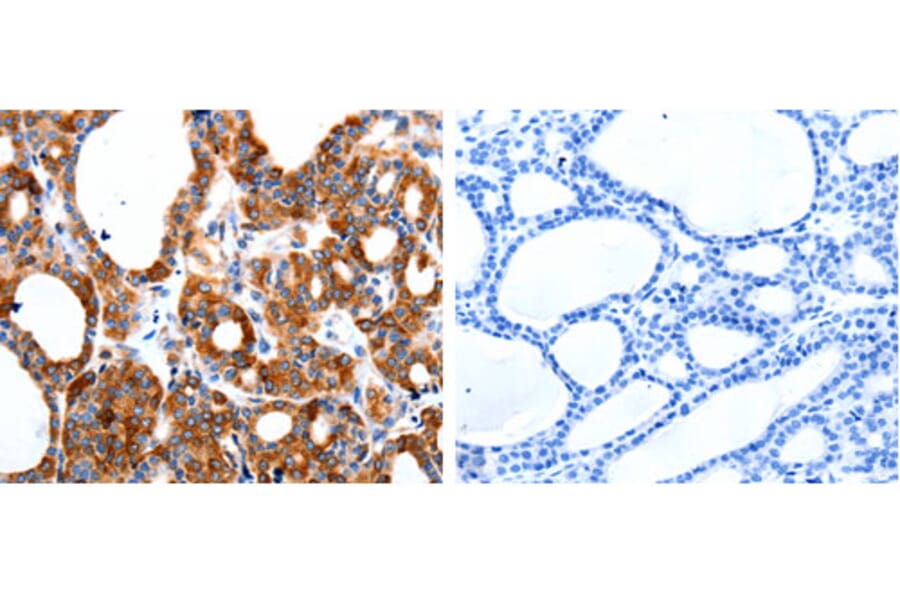 HCN1 Antibody from Signalway Antibody (31214) - Antibodies.com