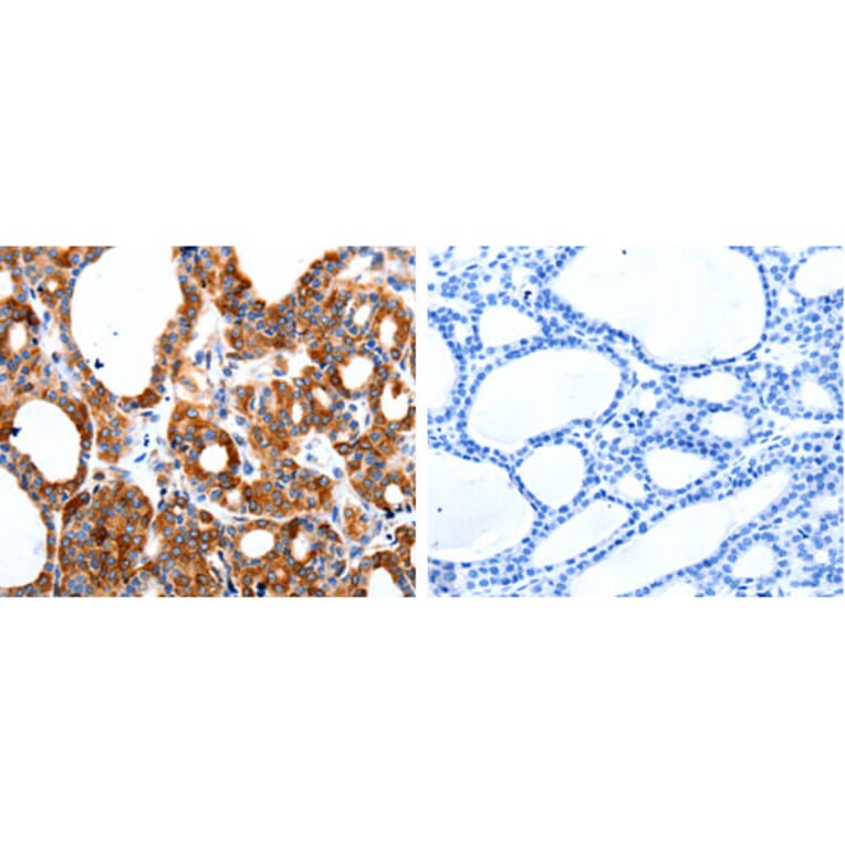HCN1 Antibody from Signalway Antibody (31214) - Antibodies.com