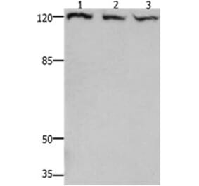 TERT Antibody from Signalway Antibody (31222) - Antibodies.com