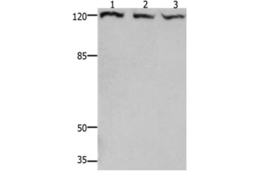 TERT Antibody from Signalway Antibody (31222) - Antibodies.com