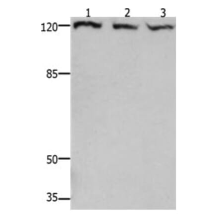 TERT Antibody from Signalway Antibody (31222) - Antibodies.com