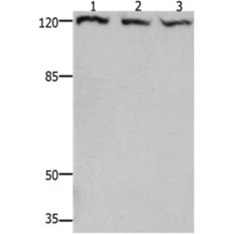 TERT Antibody from Signalway Antibody (31222) - Antibodies.com