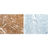 TERT Antibody from Signalway Antibody (31222) - Antibodies.com