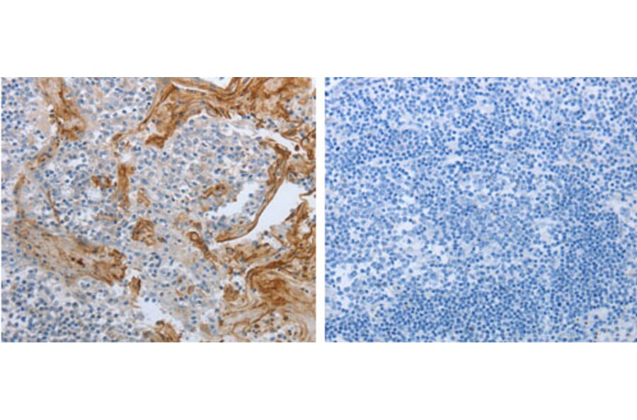 BRAF Antibody from Signalway Antibody (31224) - Antibodies.com