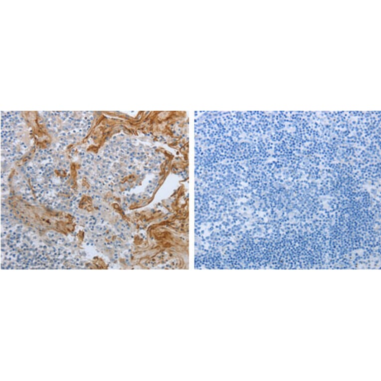BRAF Antibody from Signalway Antibody (31224) - Antibodies.com