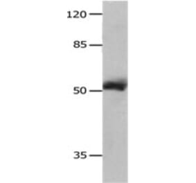 MMP8 Antibody from Signalway Antibody (31238) - Antibodies.com